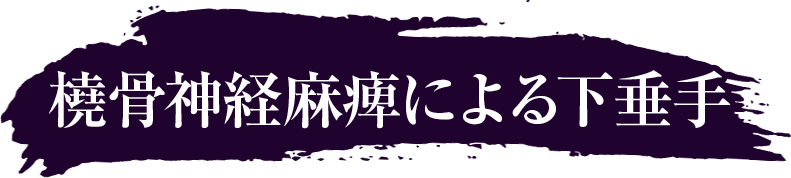 橈骨神経麻痺による下垂手